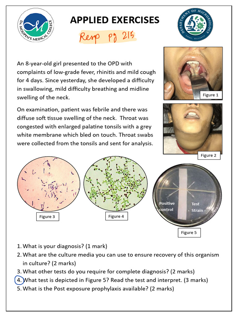 Applied Cards New | PDF | Meningitis | Diseases And Disorders