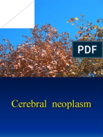 Neoplasm