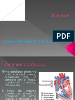 arritmias