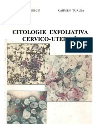 Petition Majestic Opposition Citologie Exfoliativa Cervico-Uterina | PDF