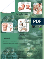 gastrectomia seminario - copia