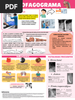 Videofluoroscopía de la Deglución: Procedimiento | PDF | Anatomía