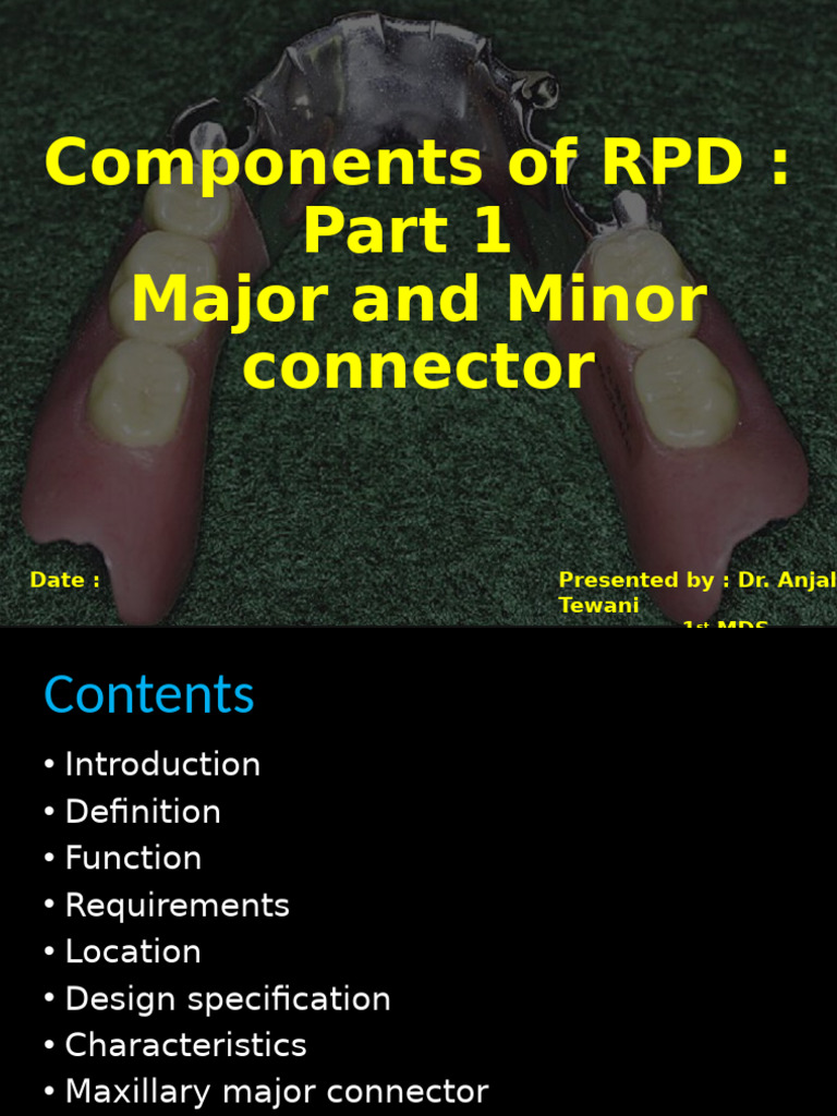 Major and Minor Connectors in RPD | PDF | Dentures | Mouth