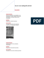 Errores en Una Radiografía Dental