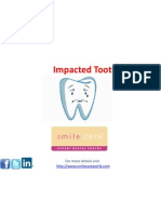 Impacted Tooth: For More Details Visit