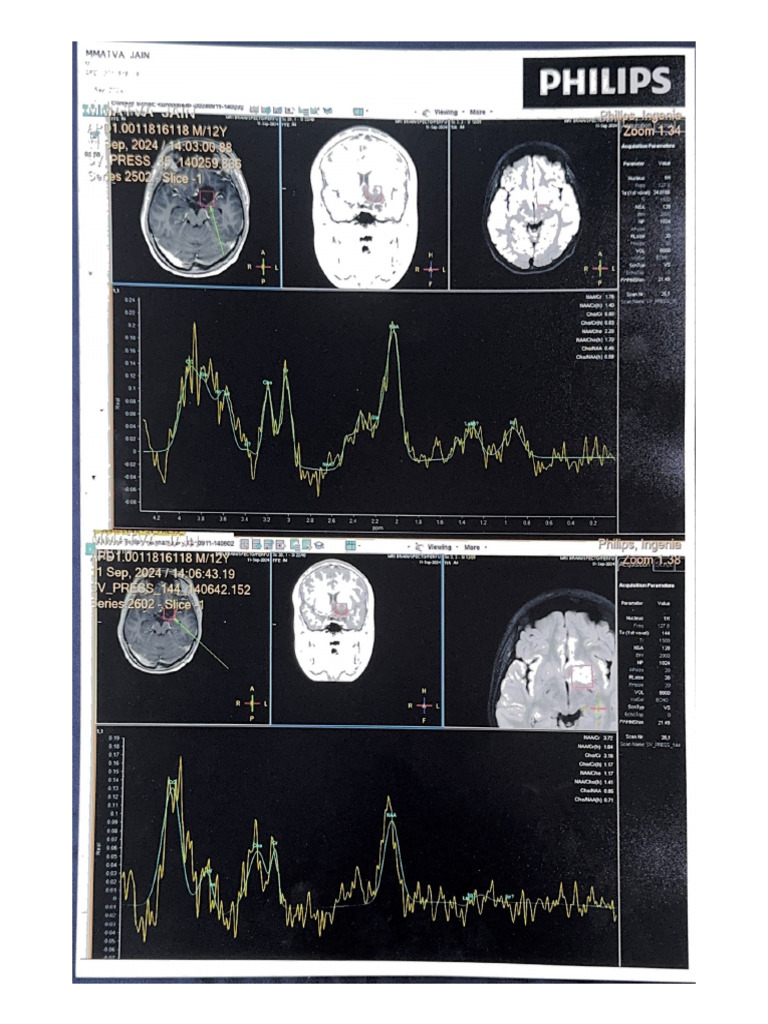 MRI Report | PDF