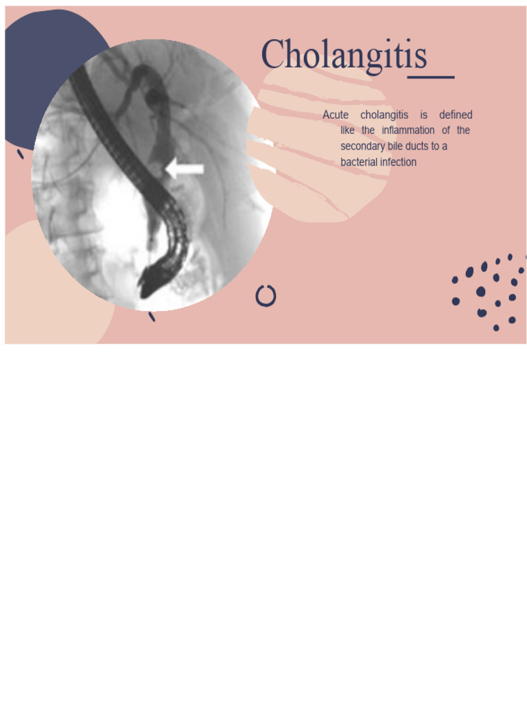 Cholangitis | PDF | Human Diseases And Disorders | Digestive Diseases