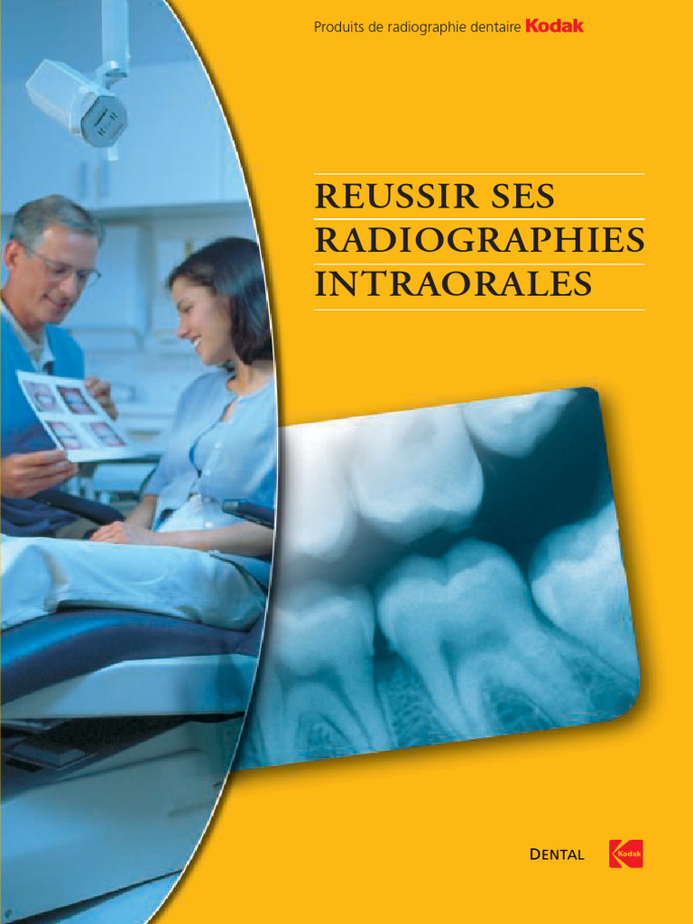 Guide pour des radiographies intraorales réussies | PDF | Radiographie ...