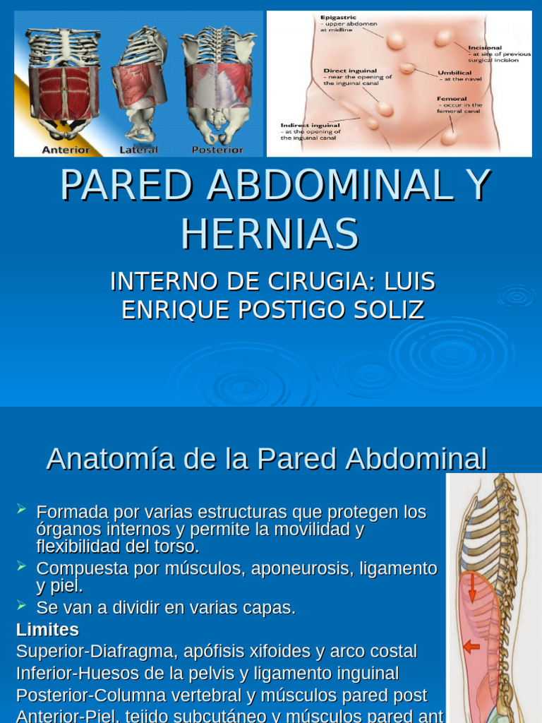 Pared Abdominal y Hernias | PDF | Abdomen
