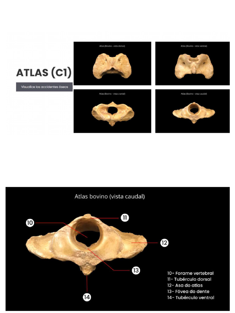 Atlas Axis | PDF