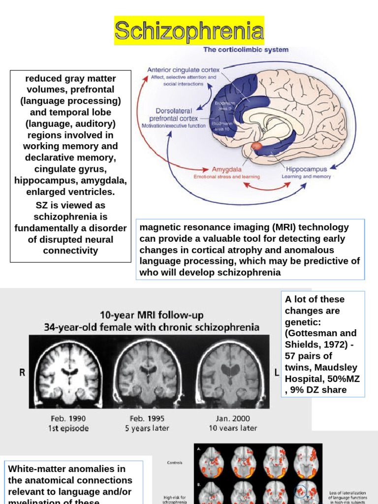 Neural Changes in Schizophrenia and Bipolar Disorder | PDF | Obsessive ...