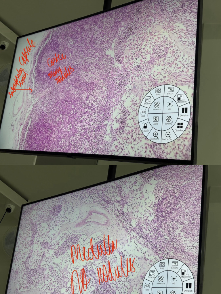 Lymph Nodes | PDF