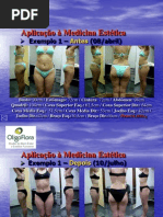 Antes e Depois - Oligoflora