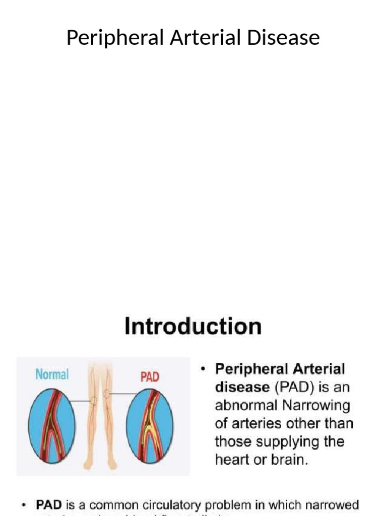 Understanding Peripheral Arterial Disease | PDF