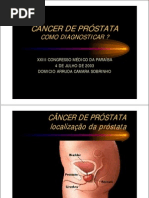 prostatacomoidentificar