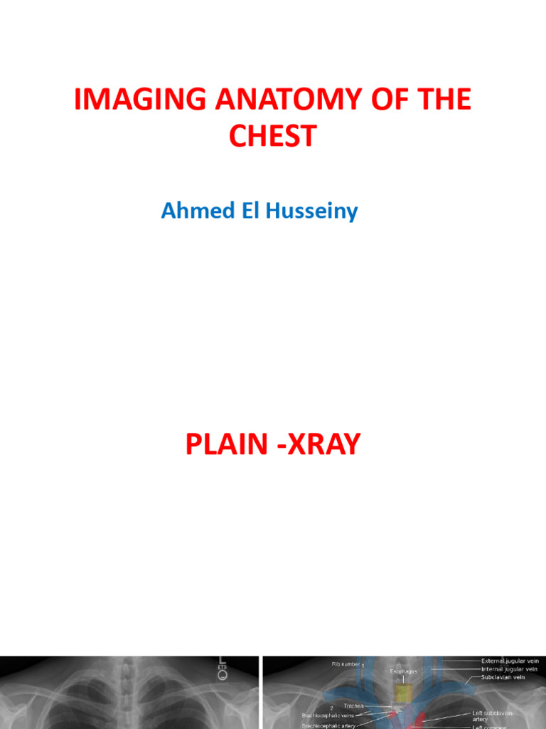 Imaging Anatomy RESP | PDF | Thorax | Lung