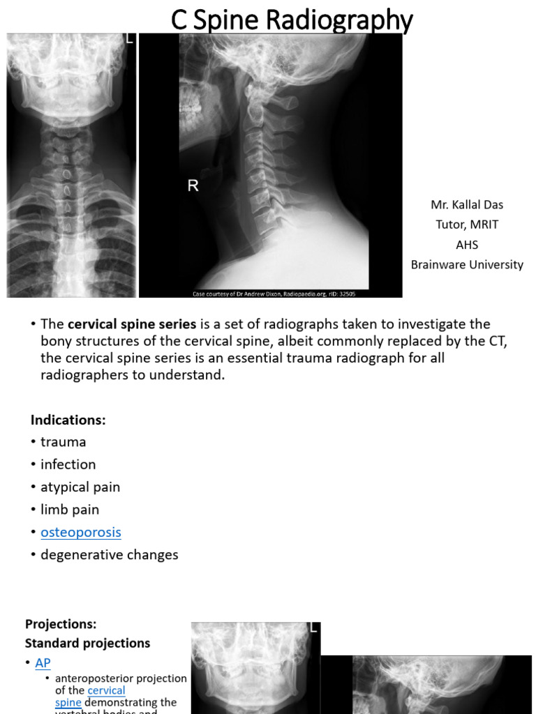 Study Material BPTS503 C Spine Radiography | PDF | Vertebra | Diseases ...