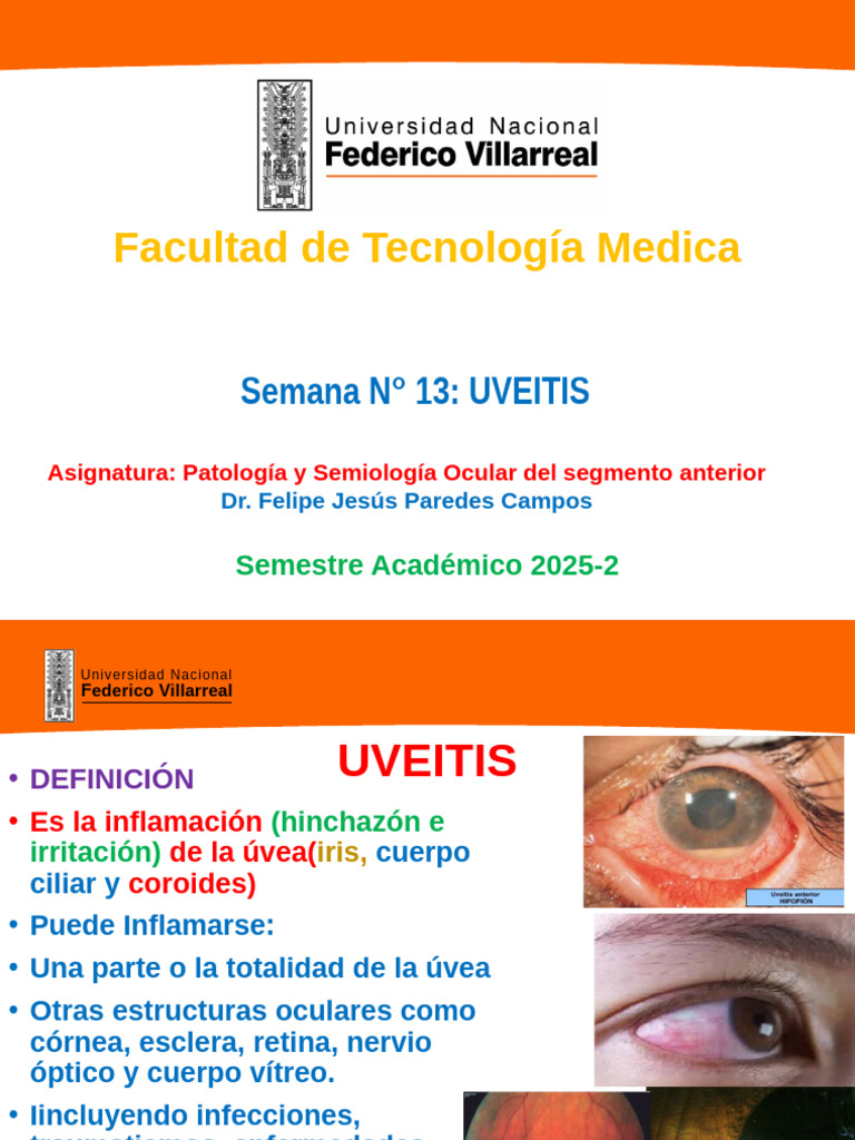 Po14 Uveitis | PDF | Ojo humano | Medicina CLINICA