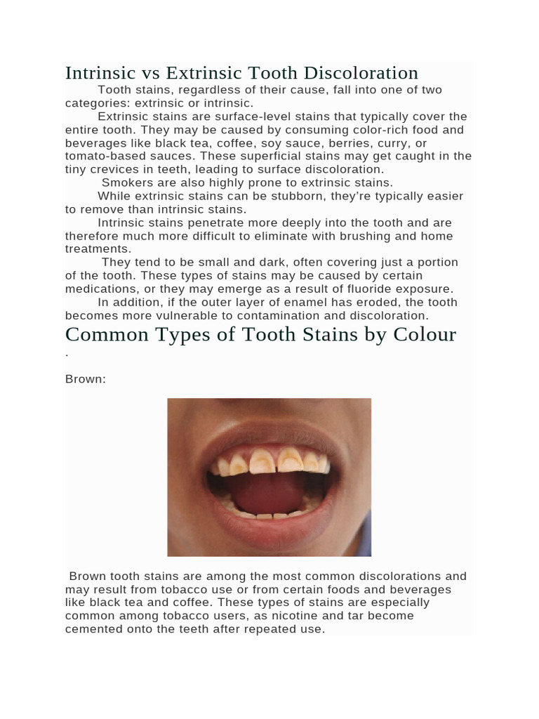 3.9 Stains and Discoloration of Teeth | PDF | Human Tooth | Tooth Enamel