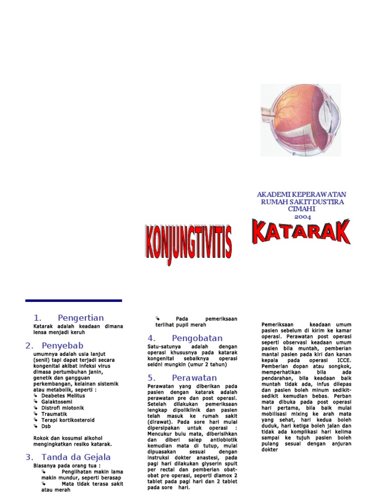 Leaflet Katarak