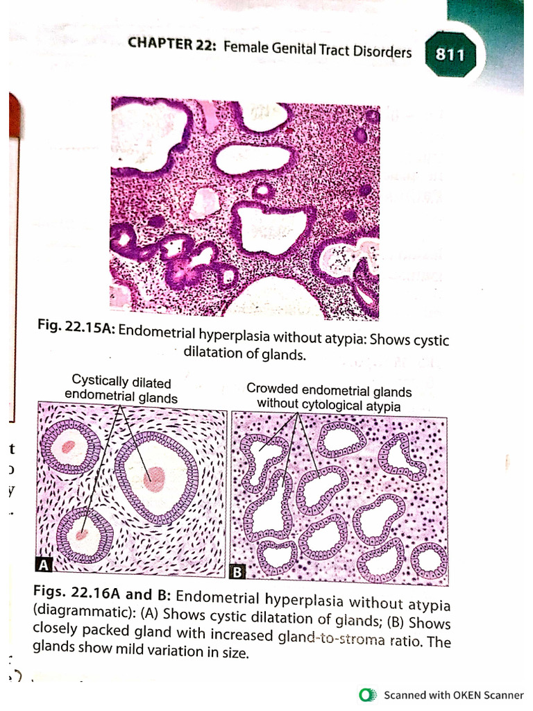 Female Pathology Diagram | PDF