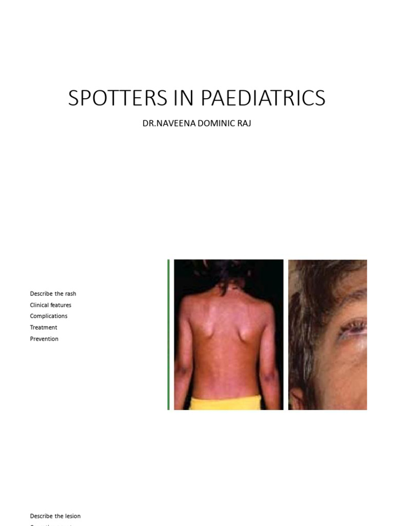 Pediatric Spotters: Rashes & Conditions | PDF