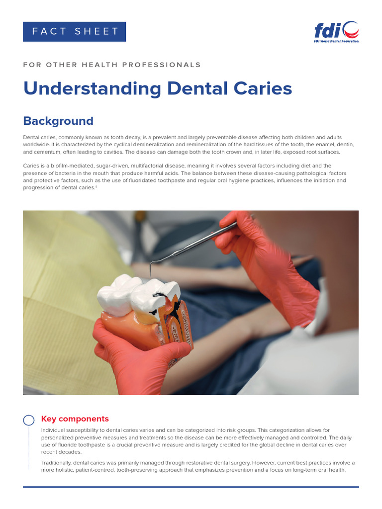 Key Insights on Dental Caries Management | PDF | Human Tooth | Oral Hygiene