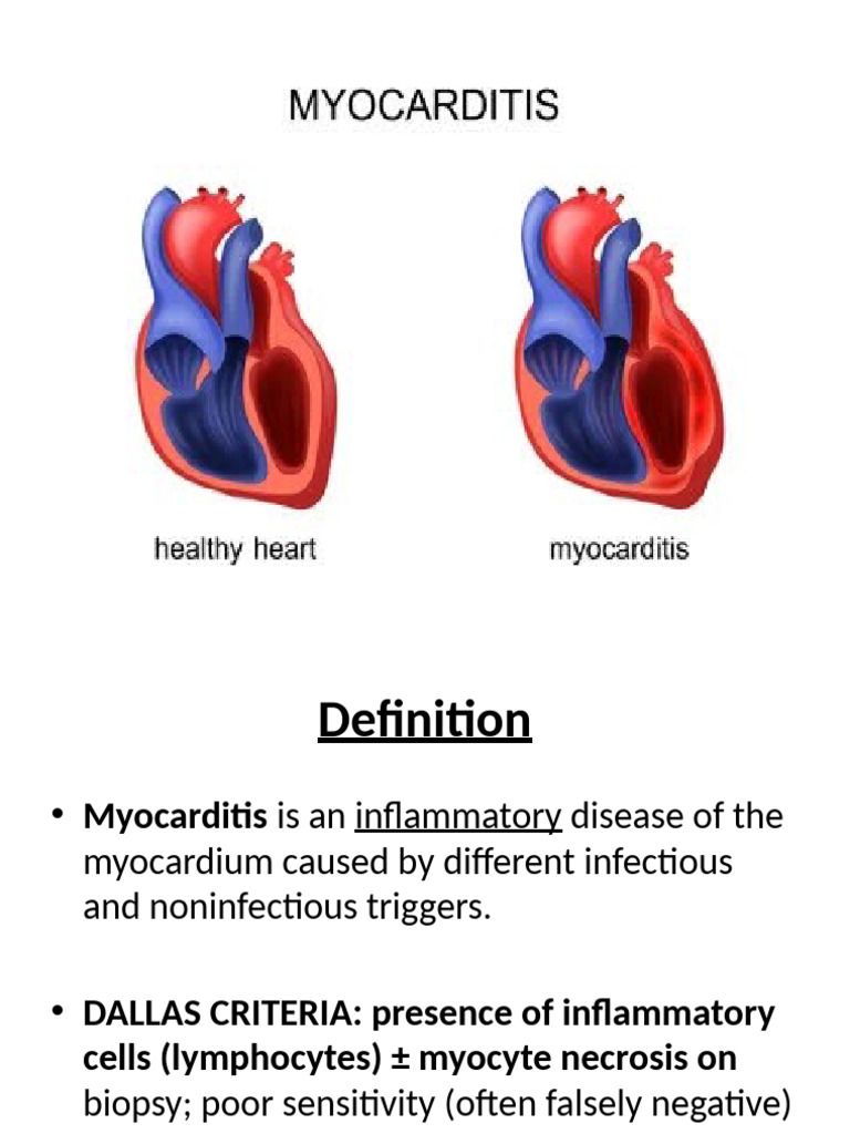 Myocarditis | PDF | Heart Failure | Heart
