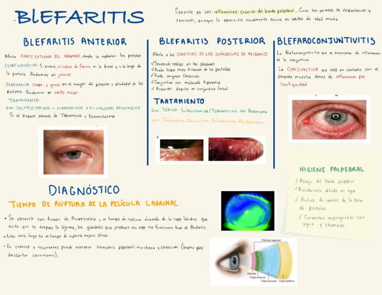Blefaritis: Tipos, Tratamientos y Diagnóstico | PDF | Medicina CLINICA ...