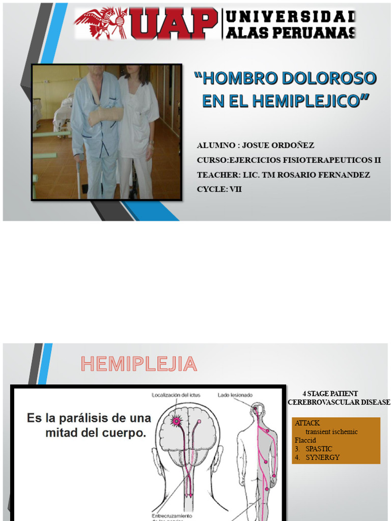 Physiotherapy for Hemiplegic Shoulder Pain | PDF | Shoulder ...