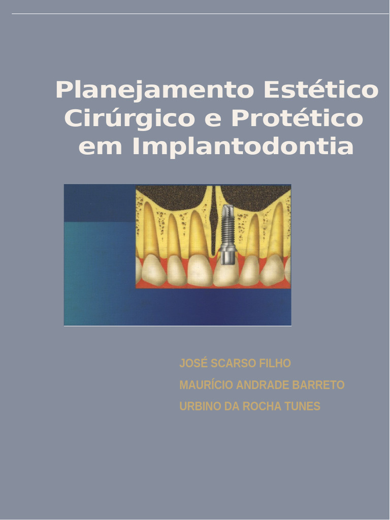 PlanEstCirProtImplantodontia SCARSO | PDF | Dente humano | Odontologia