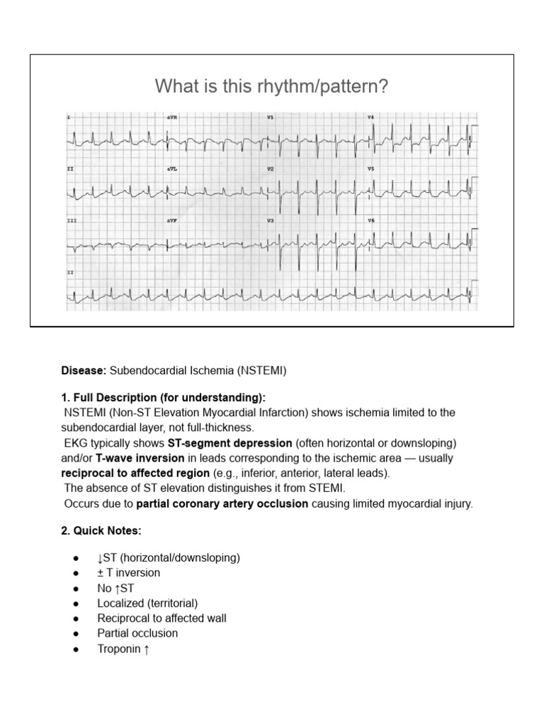 EKGs (With Diagnostic Descriptions) (1-10) | PDF | Electrocardiography ...