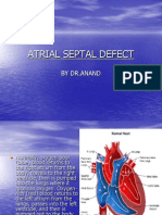 Atrial Septal Defect: by DR - Anand