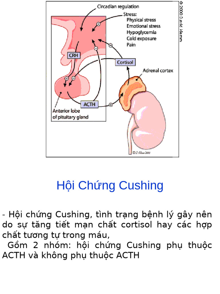 Cushing | PDF