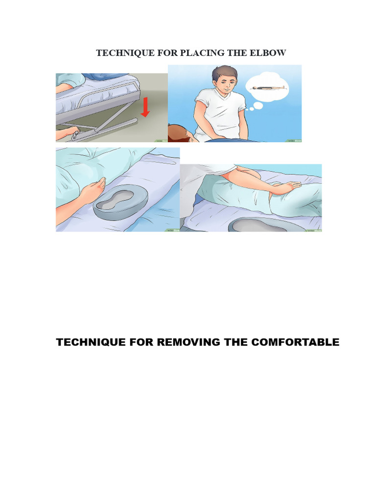 Technique For Elbow Placement | PDF