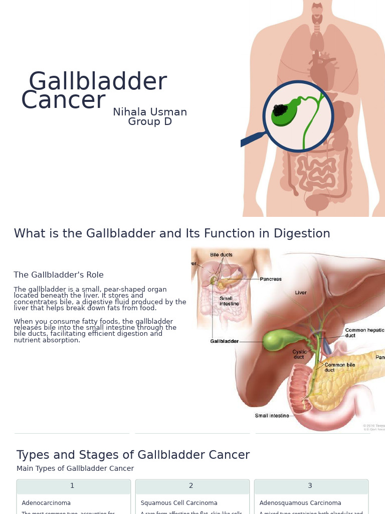 Understanding Gallbladder Cancer | PDF | Gallbladder | Cancer