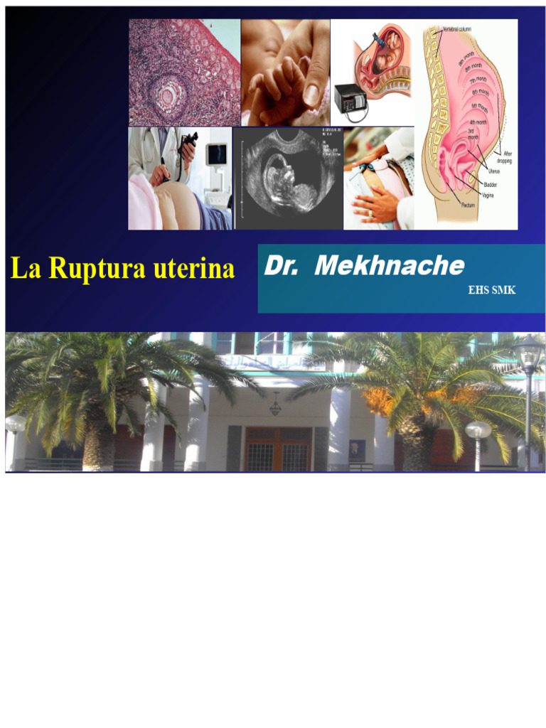 Ruptura Uterina: Causas y Tratamiento | PDF | Parto | El embarazo