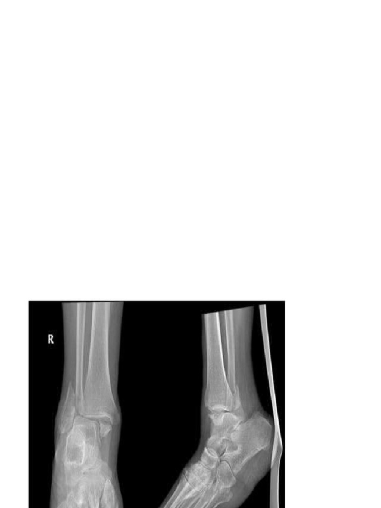 Surgery Osces | PDF