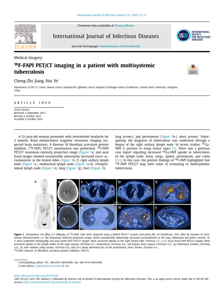 18F FAPI PET CT Imaging in A Patient With Multisys | PDF | Positron ...