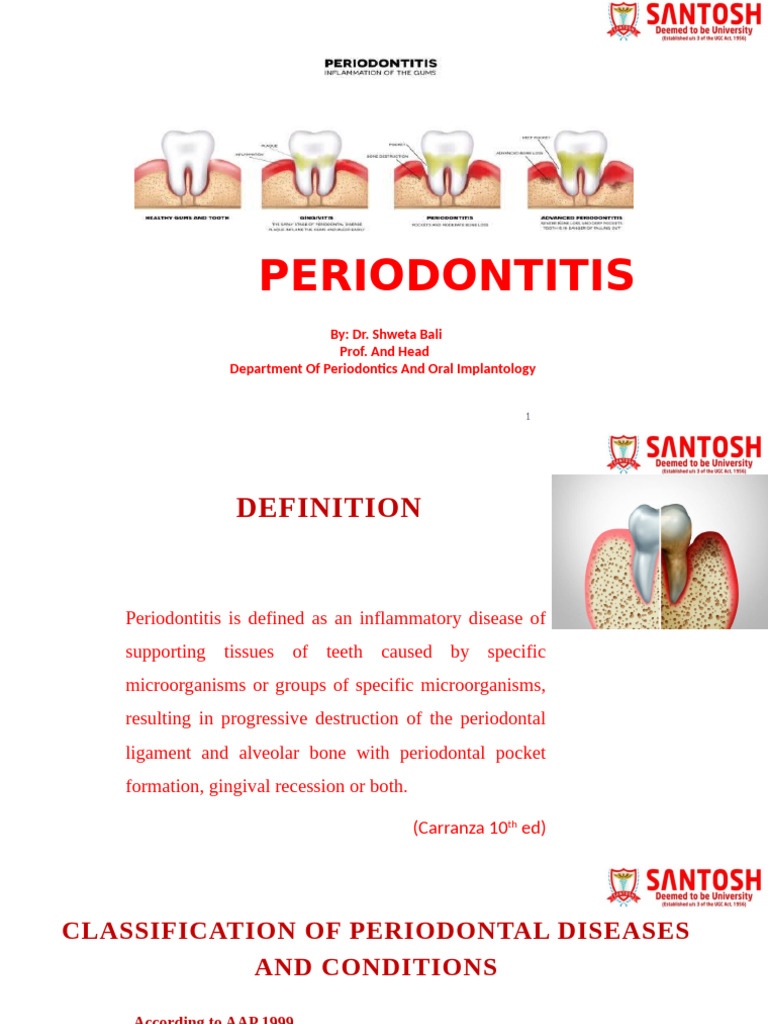 Understanding Periodontitis: Types & Treatment | PDF | Periodontology ...