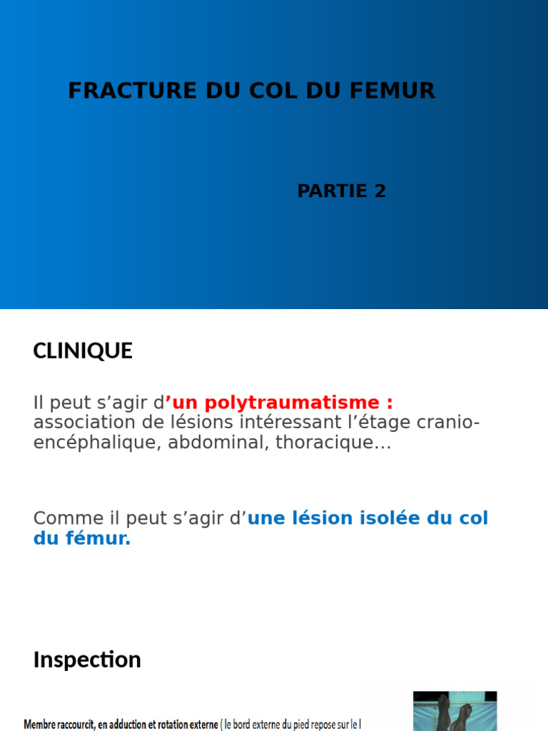 Fracture du col du fémur : clinique et diagnostic | PDF