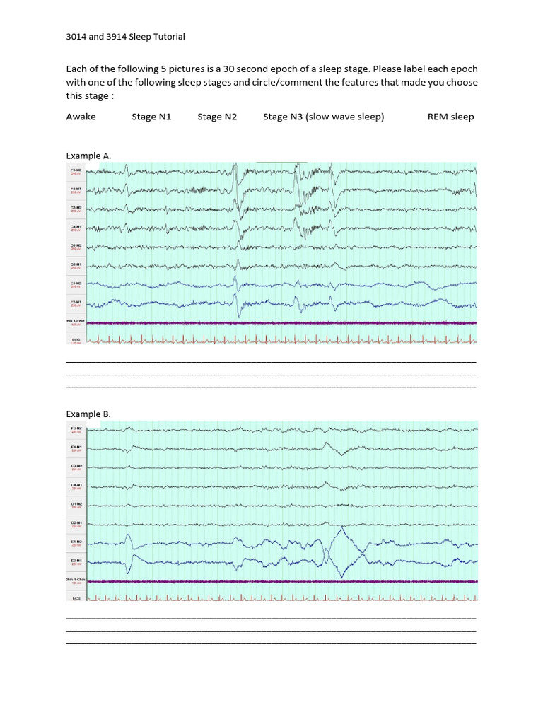 Sleep Tutorial Pub Quiz Pdf