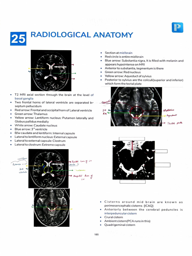Radiological Anatomy | PDF