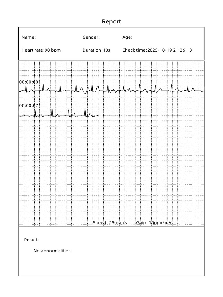 Heart Rate Report: No Abnormalities | PDF