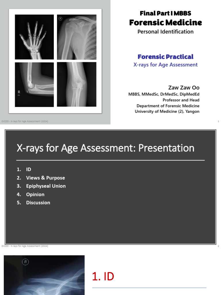 X-rays for Age Assessment in Forensics | PDF | Joints | Skeletal System