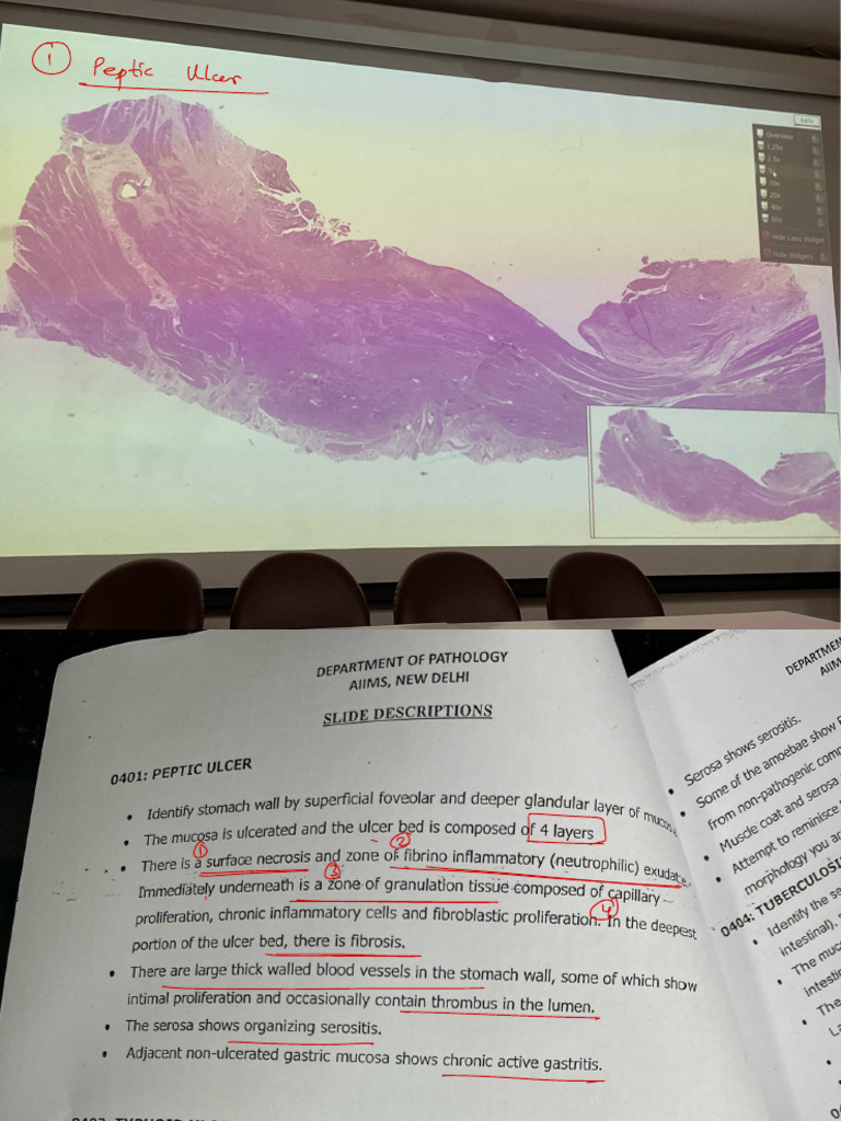 Understanding Leptic and Intestinal Lesions | PDF