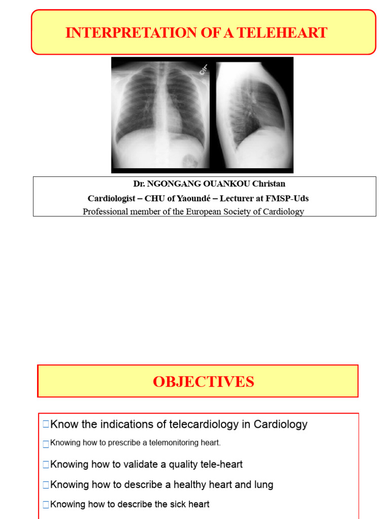 Chest X-Ray - Teleheart - 075458 | PDF | Heart | Cardiology