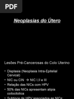 NEOPLASIA DE ÚTERO.ppt