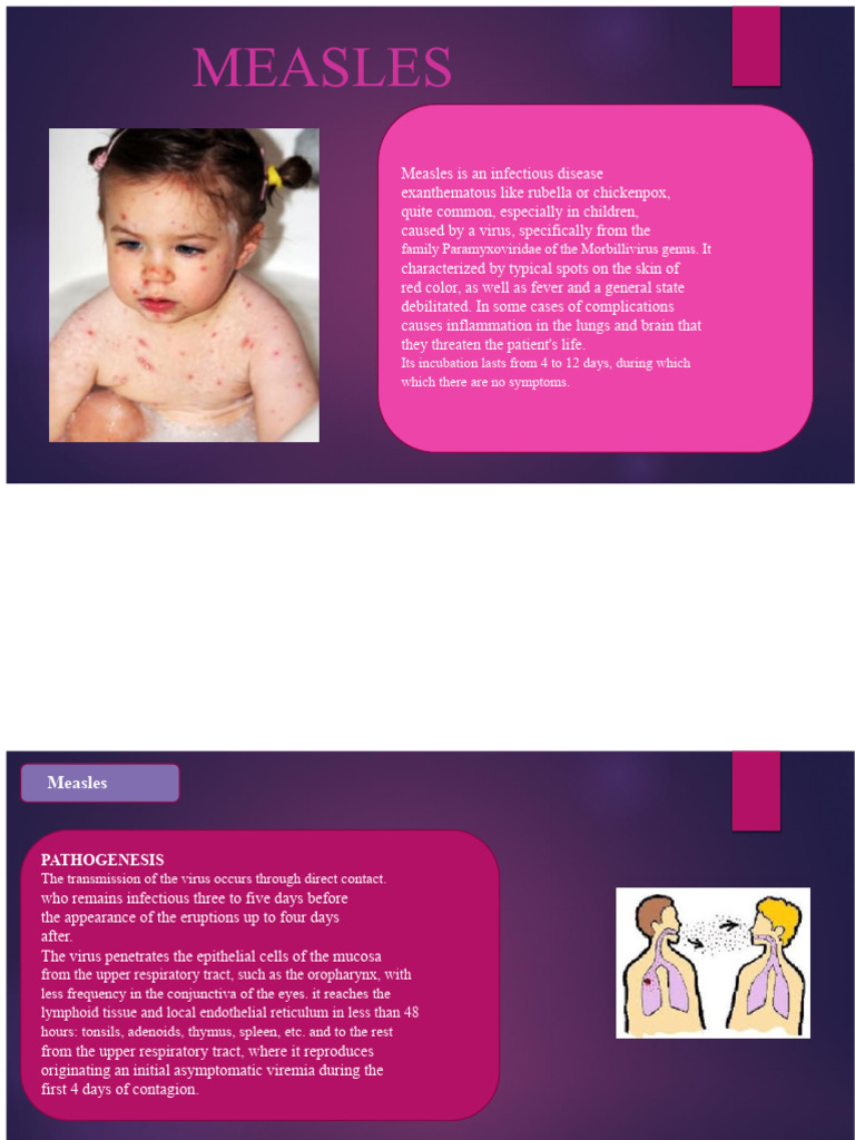 MEASLES Slides | PDF | Measles | Infection