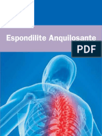 Espondilite_Anquilosante_SBR